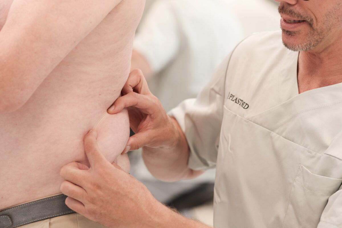 Dr. Diedrichson, Arzt bei der Plastmed Privatklinik tatstet die Taille eines Mannes zur Vorbereitung einer Kryolipolyse mit CoolSculpting ab