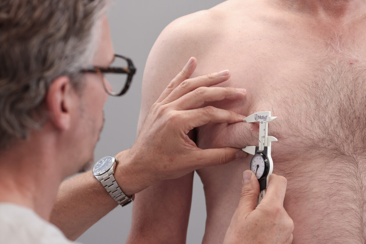 Mann wird vor einer Brustkorrektur bei Plastmed Düsseldorf untersucht von Dr. med. Till Scholz, der seine Brust ausmisst